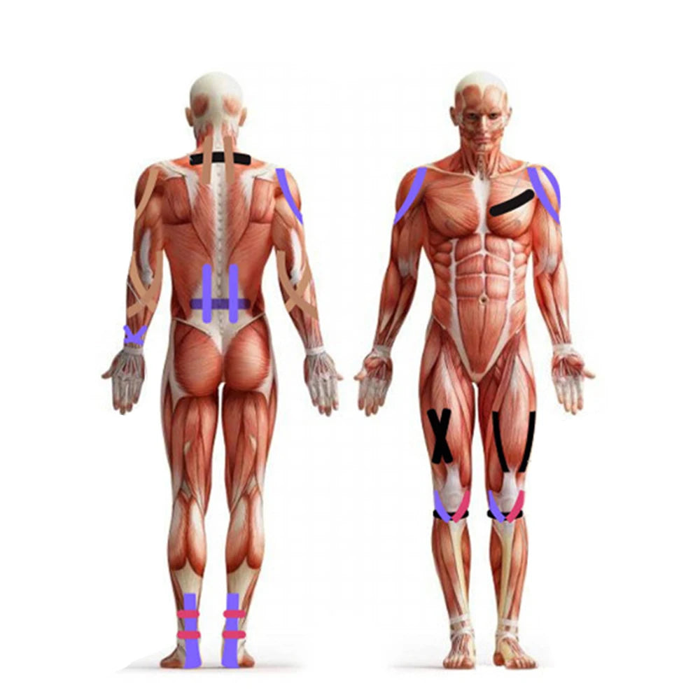 Elastisches Sport-Kinesio-Tape, sportliche Erholungsaufkleber, Fitness-Bandagen, Kinesiologie-Stützpolster, Kniegelenkschutz, 5 m x 5 cm